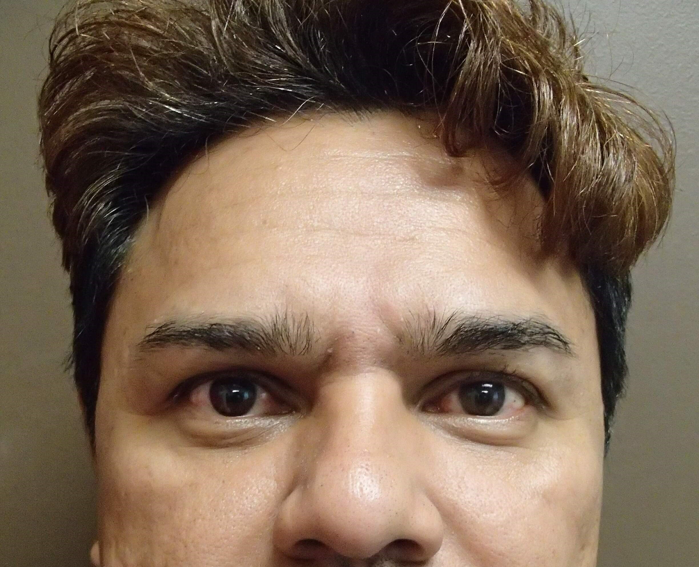 Before Image