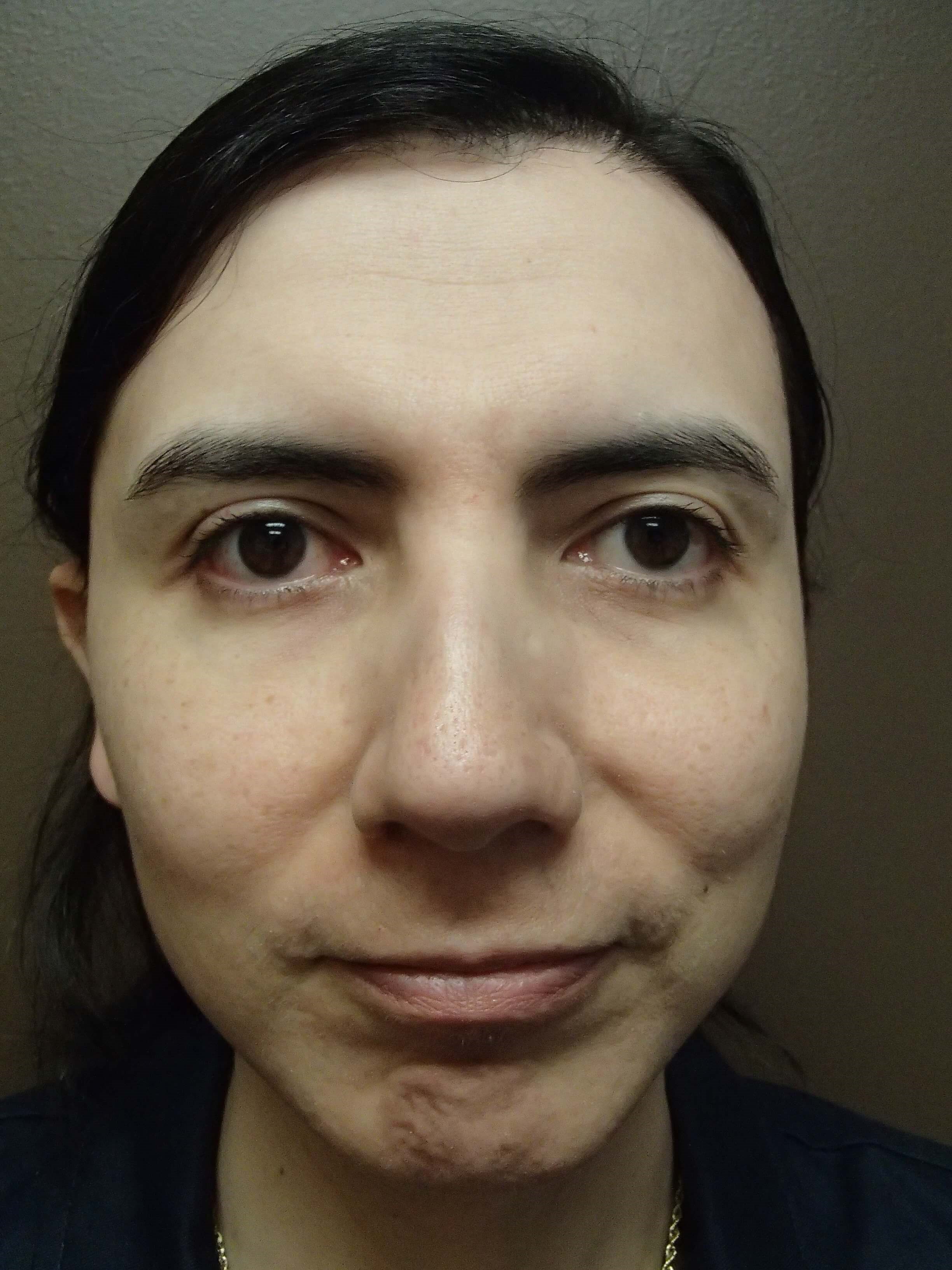 Before Image