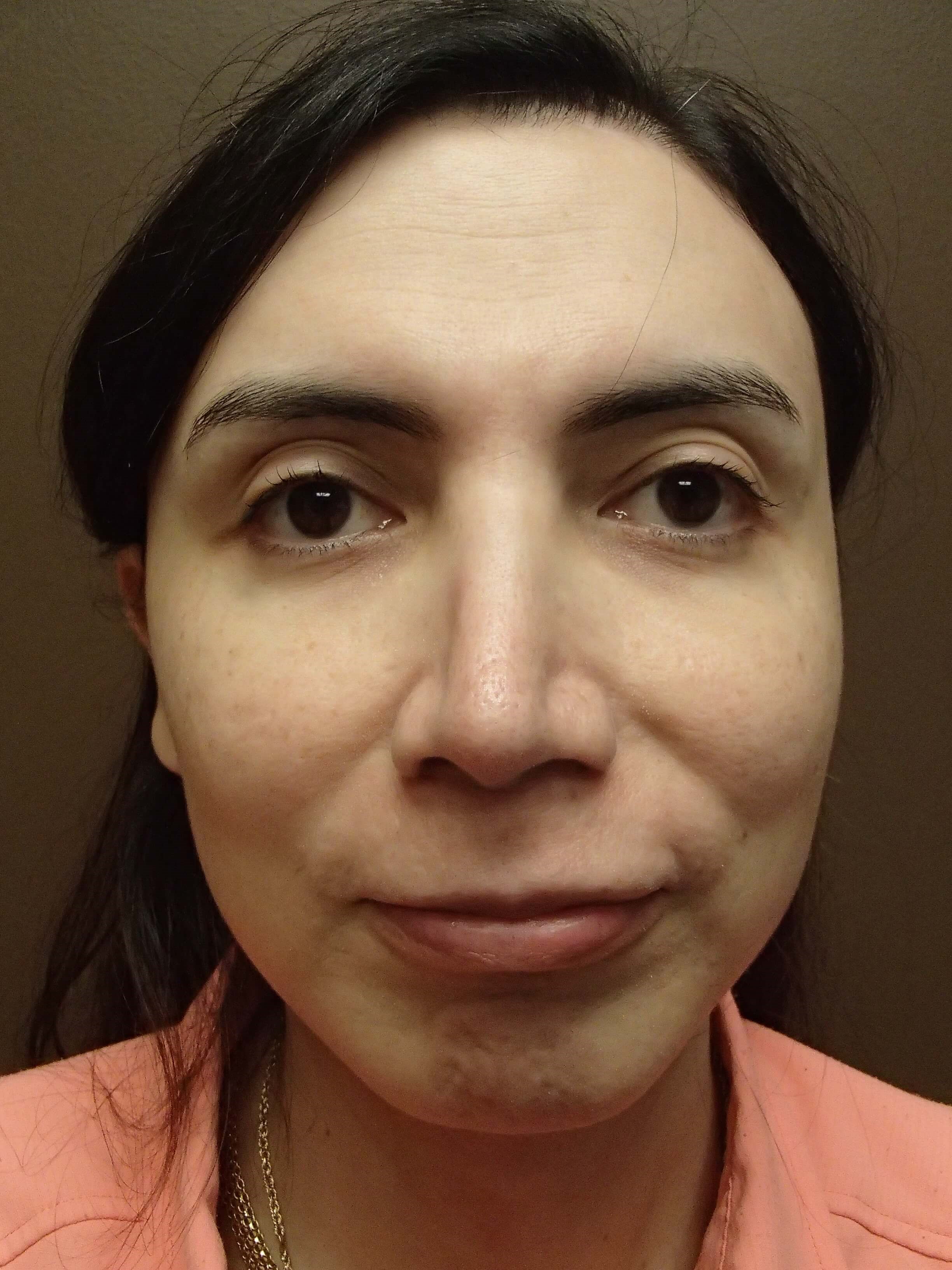 After Image