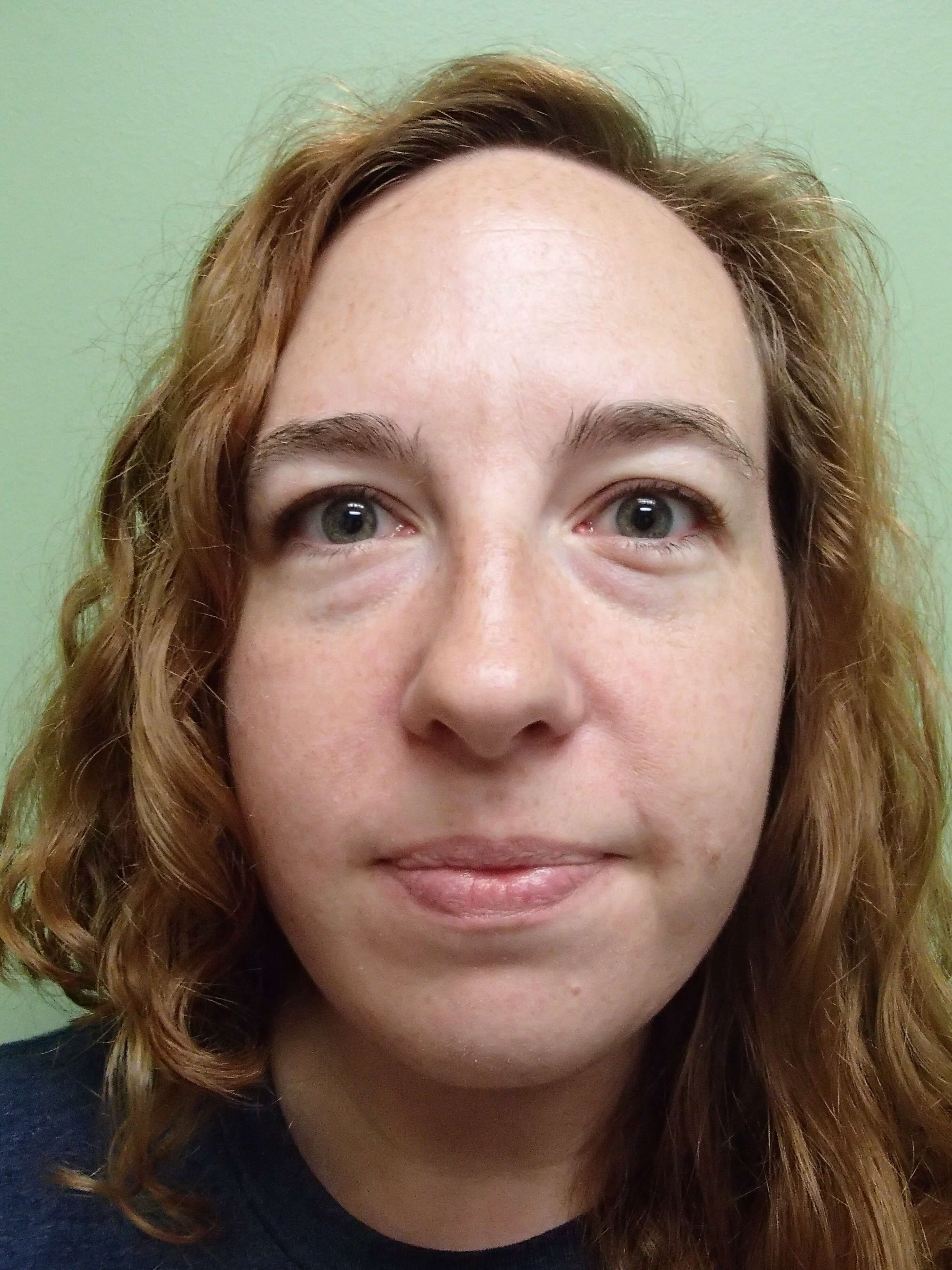 Before Image