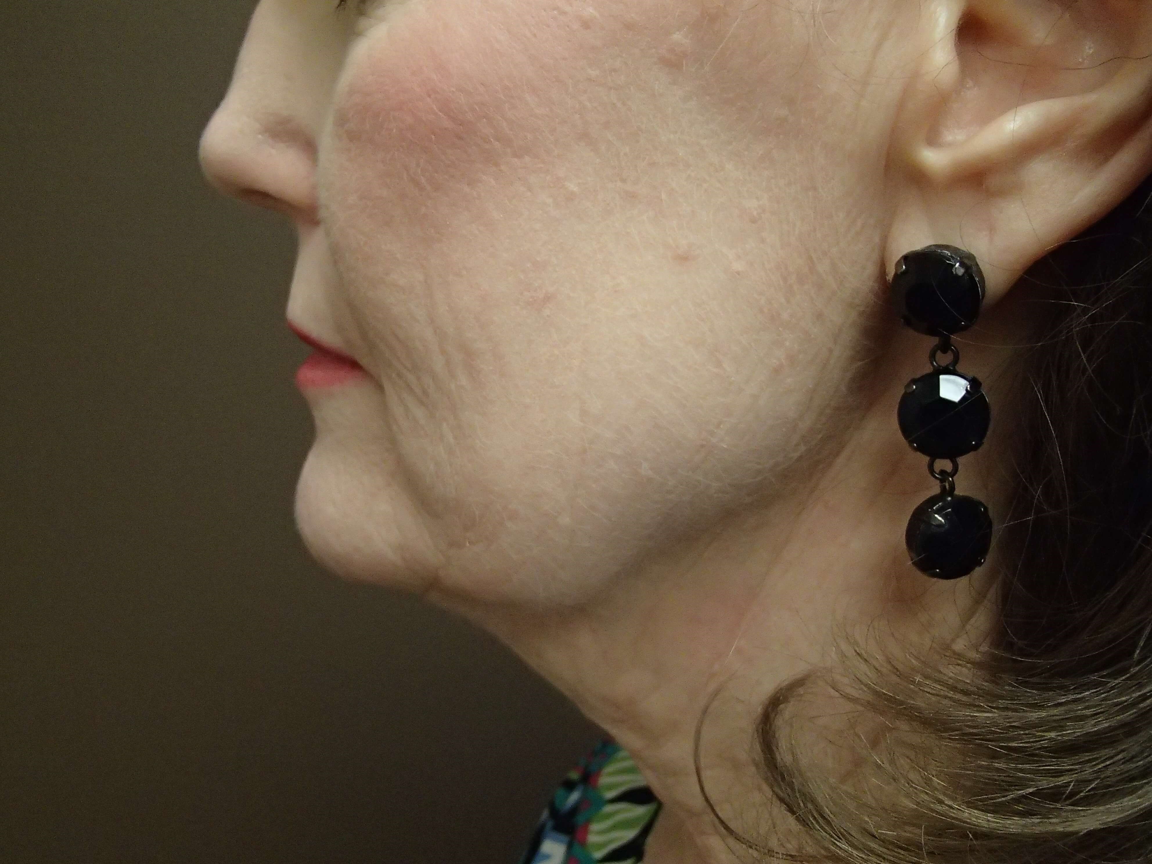 Facelift Before