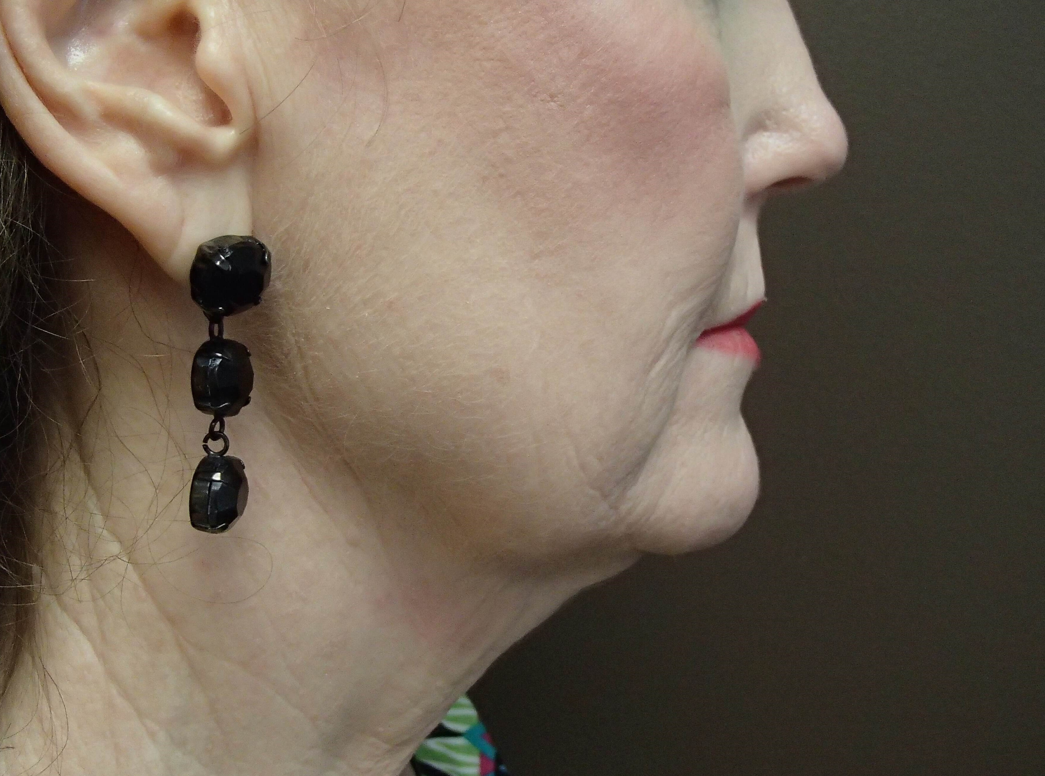 Facelift Before