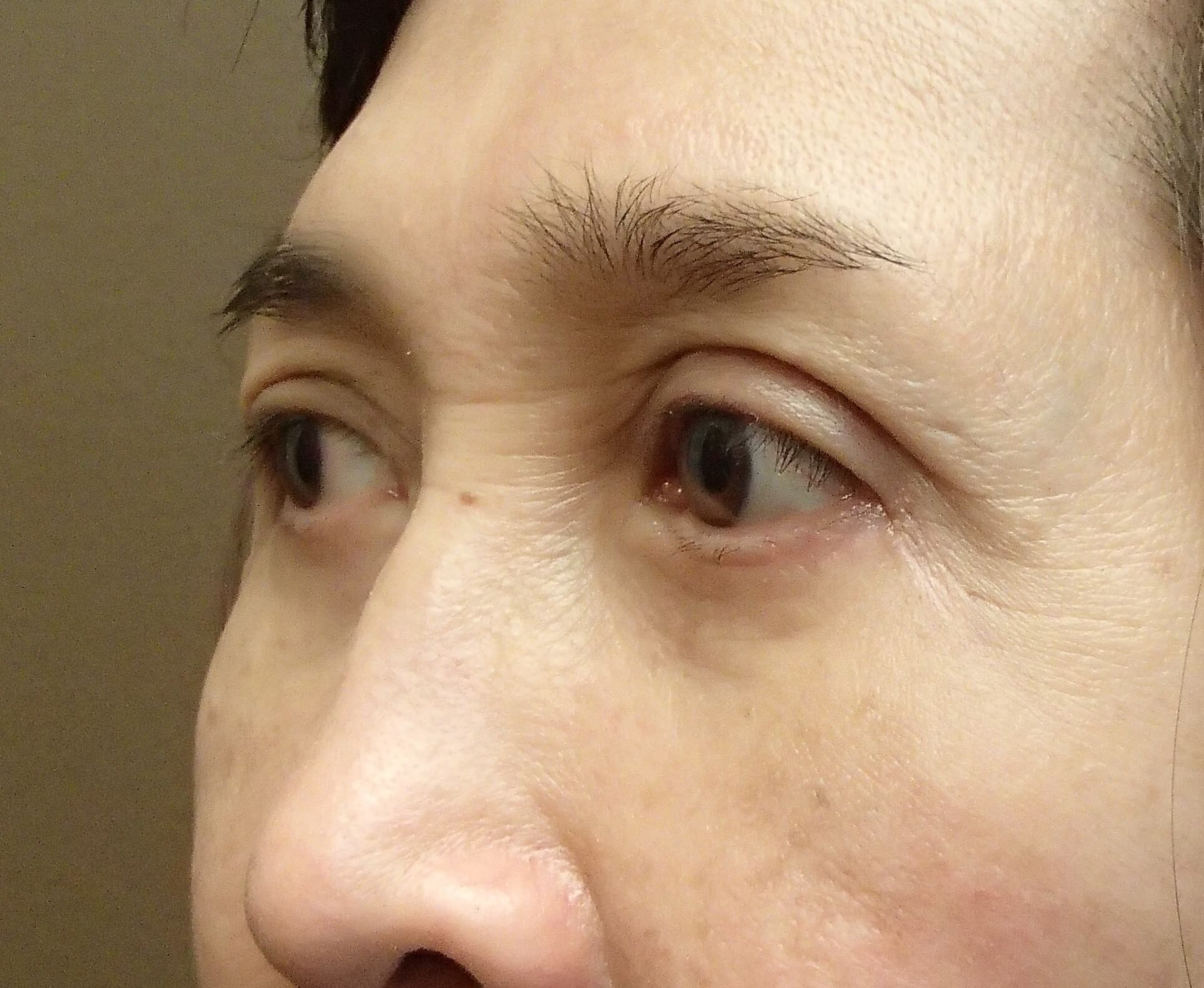 After Image