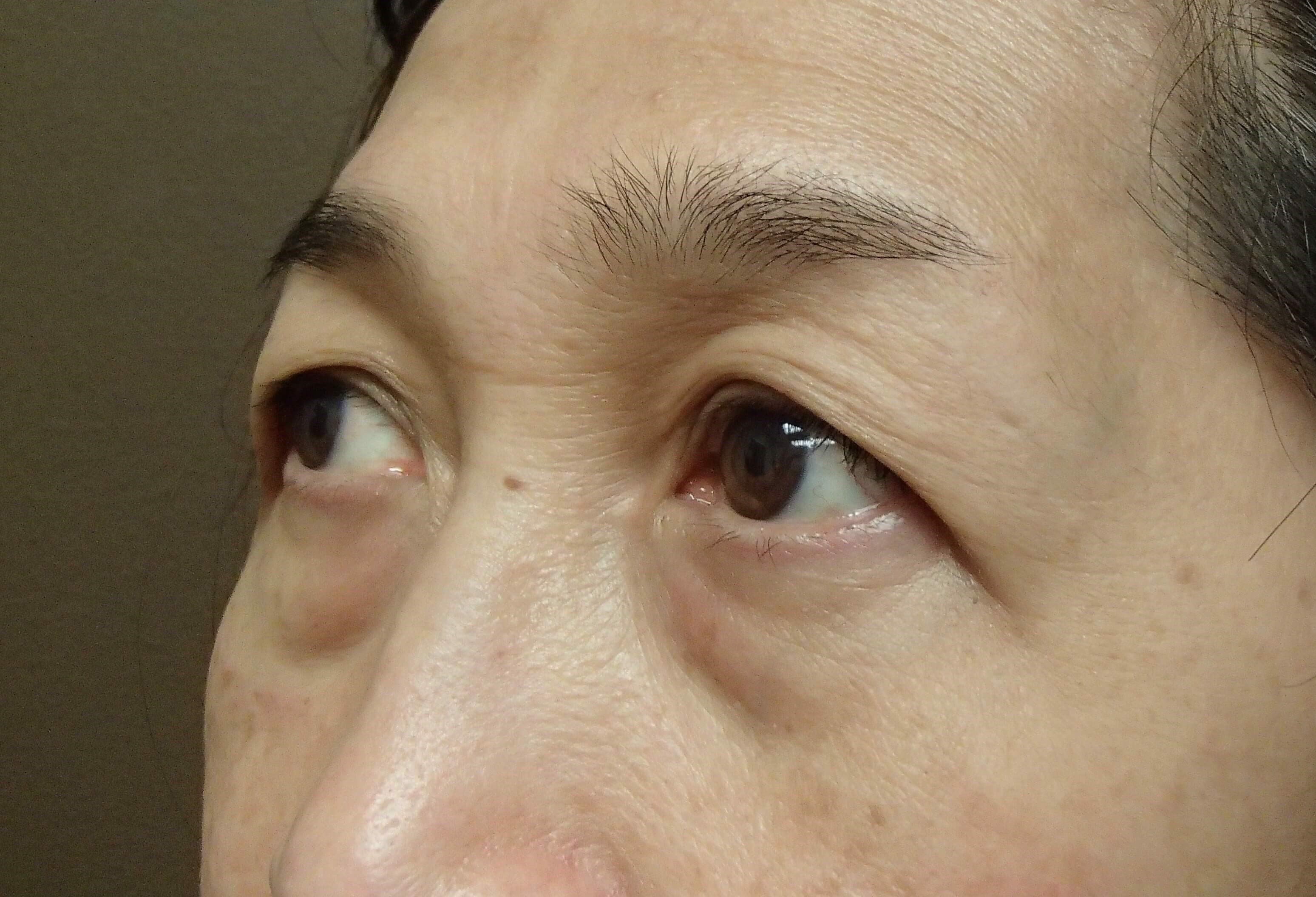 Before Image