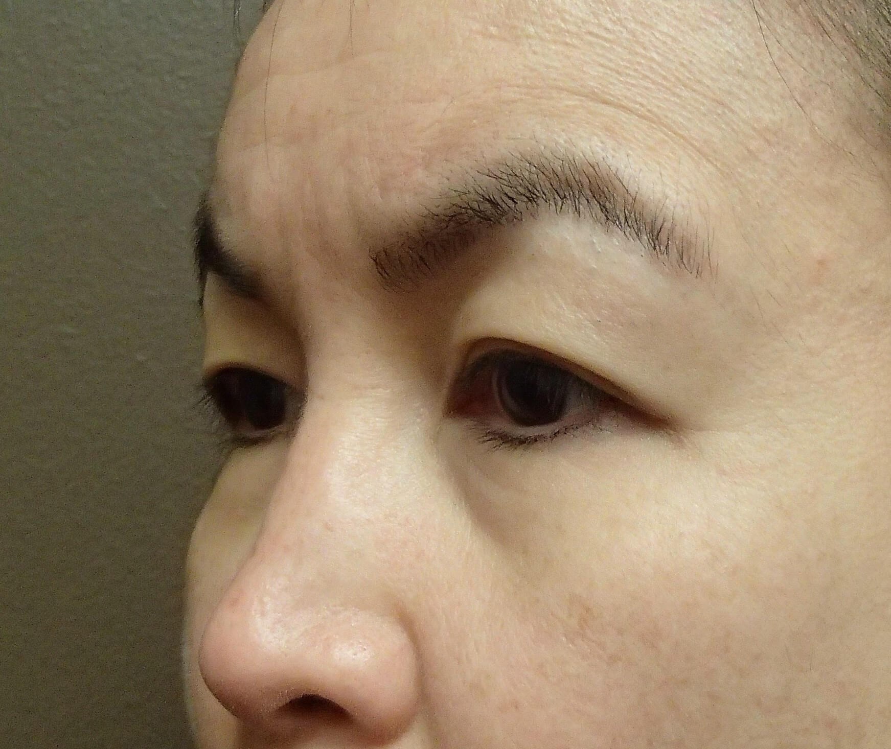 Before Image