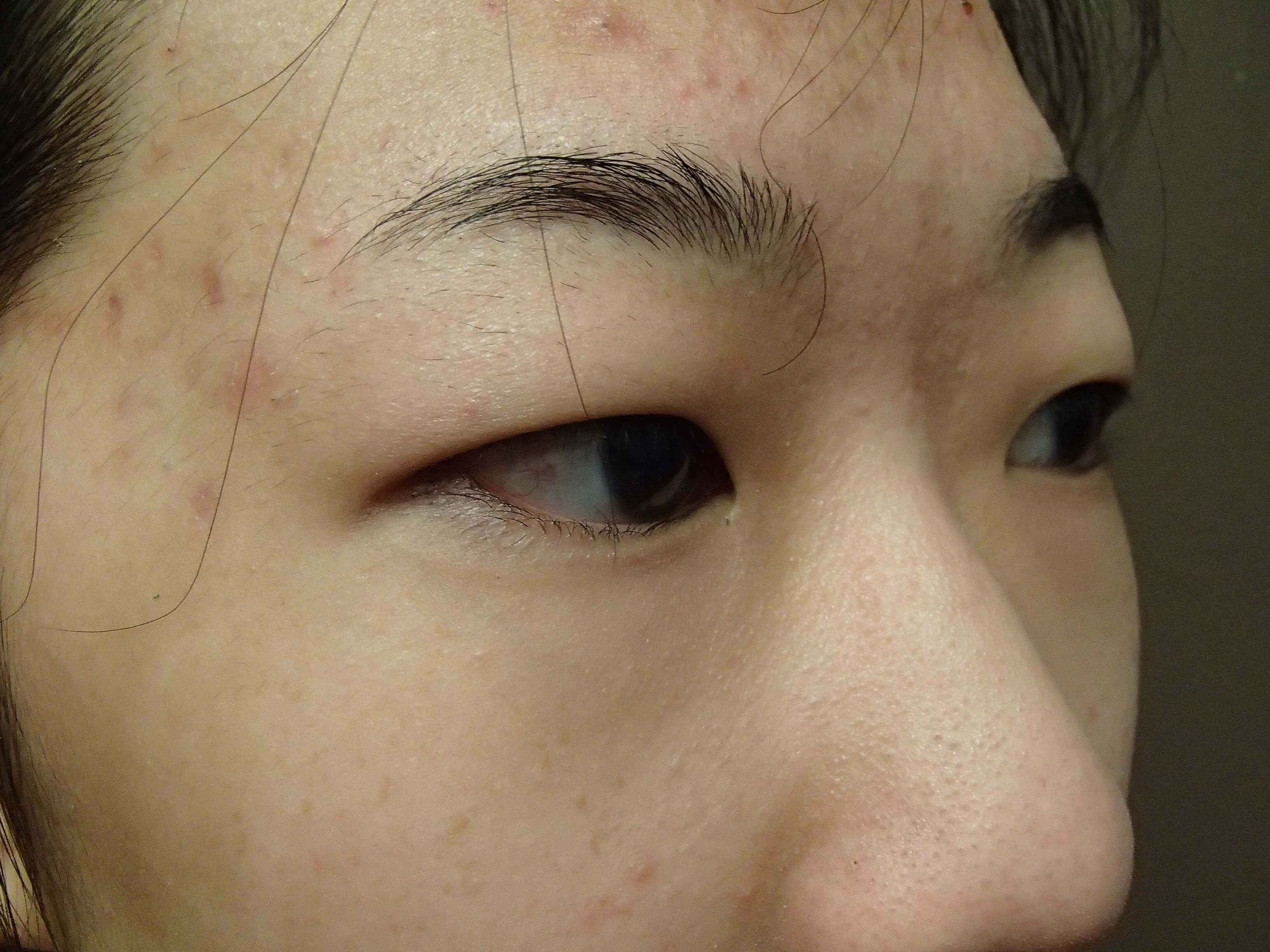 Before Image