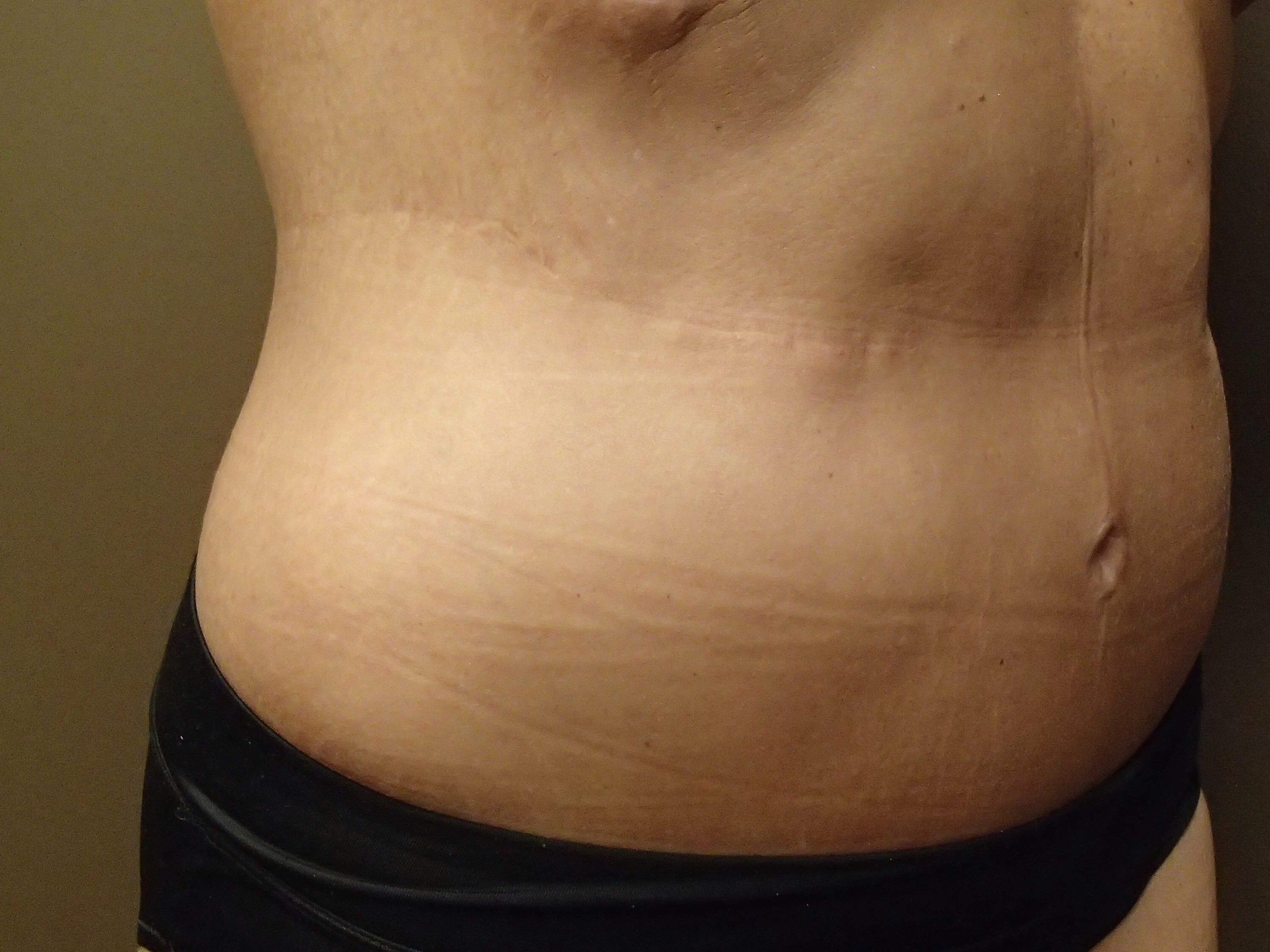 Timeless Tuck After