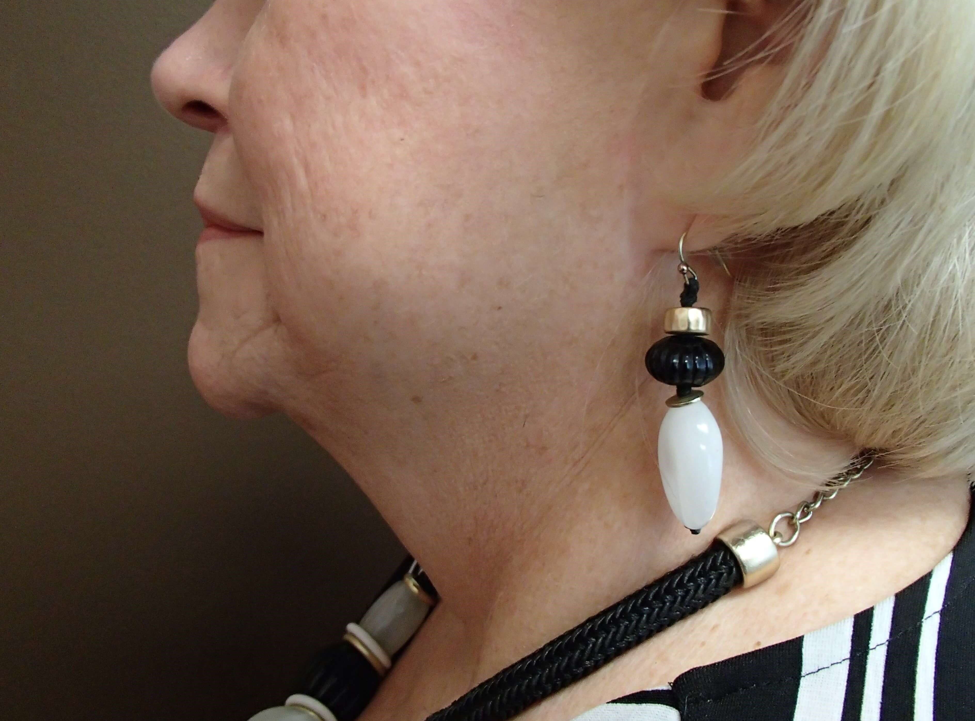 Necklift Before