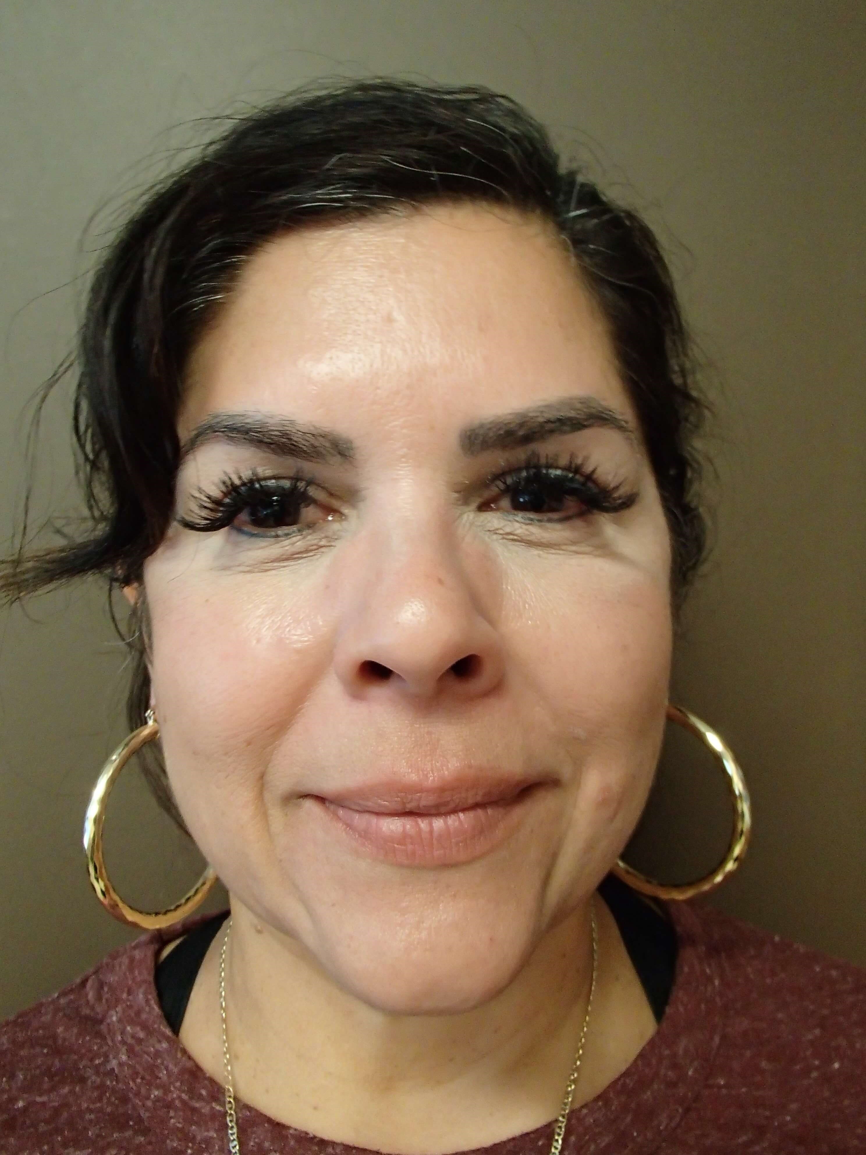 Necklift Before