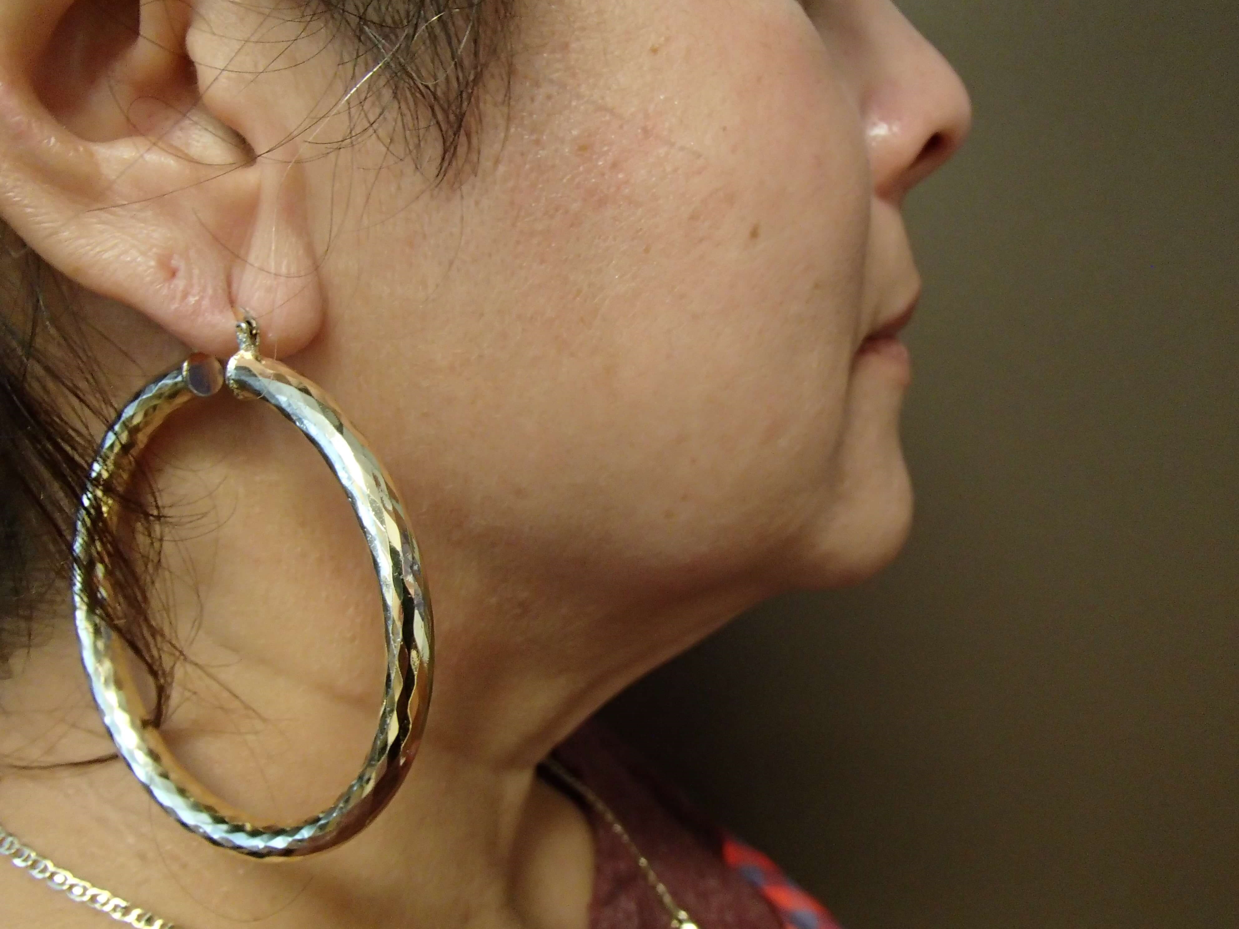 Necklift Before