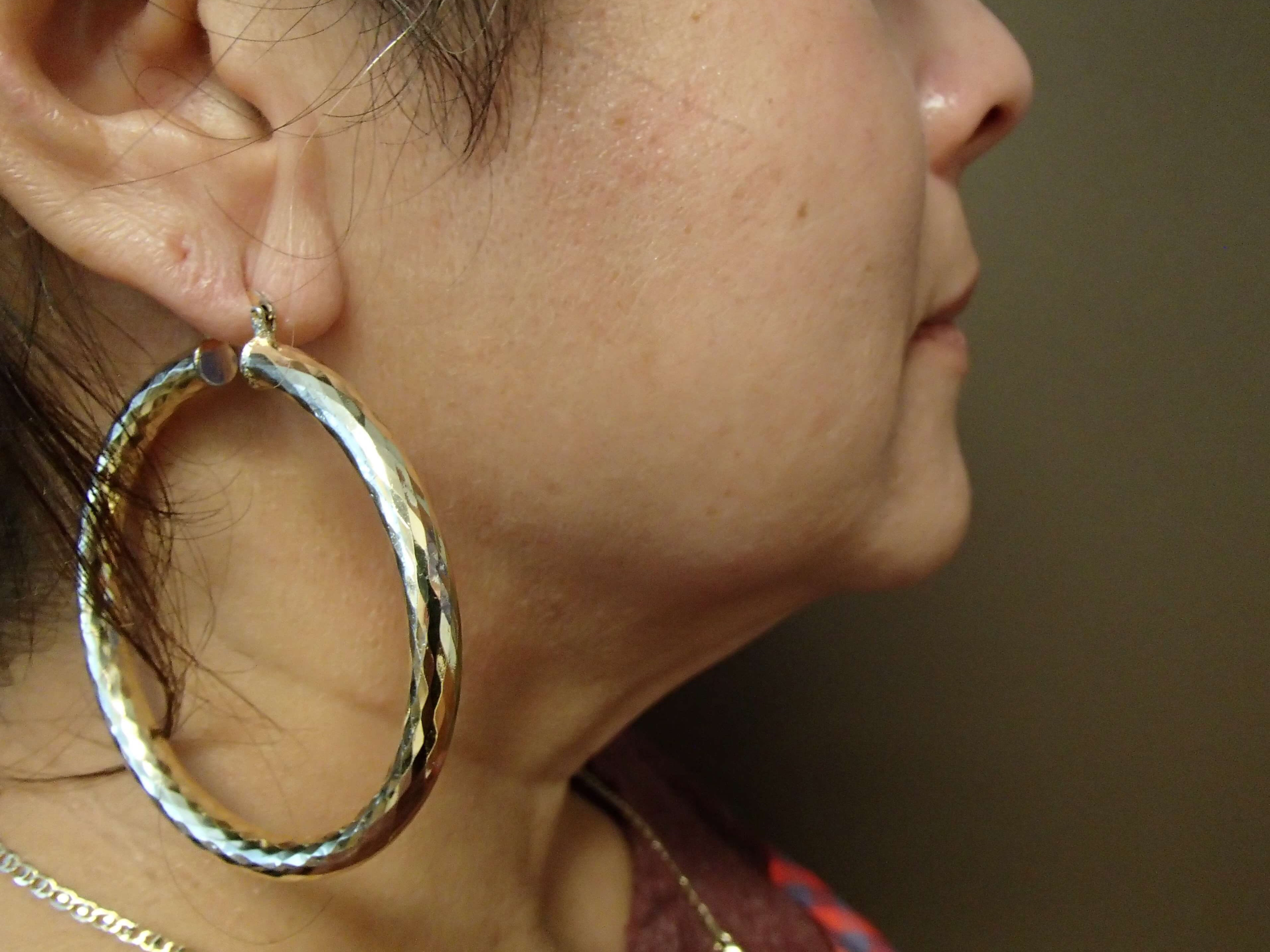 Necklift Before