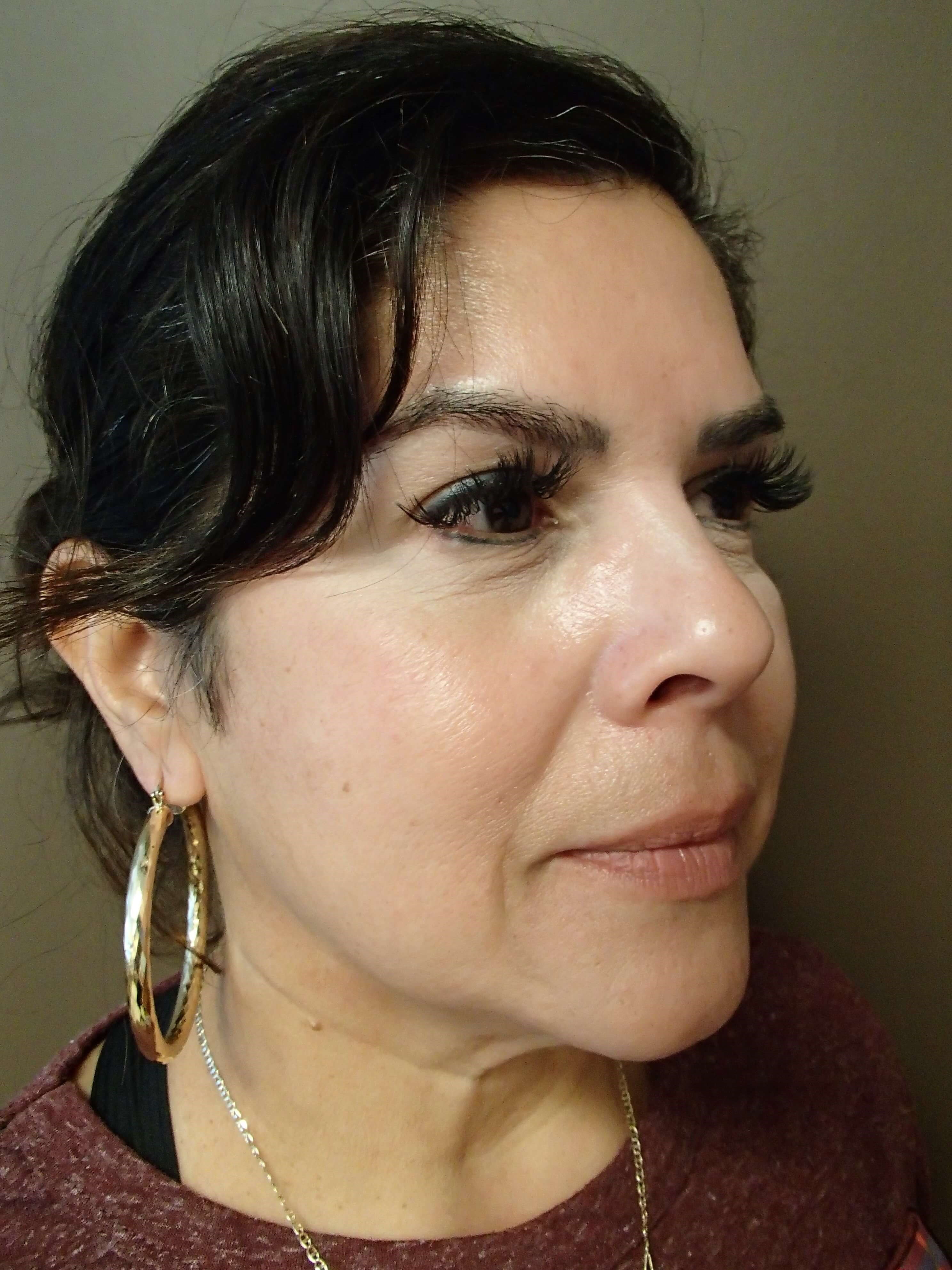 Necklift Before