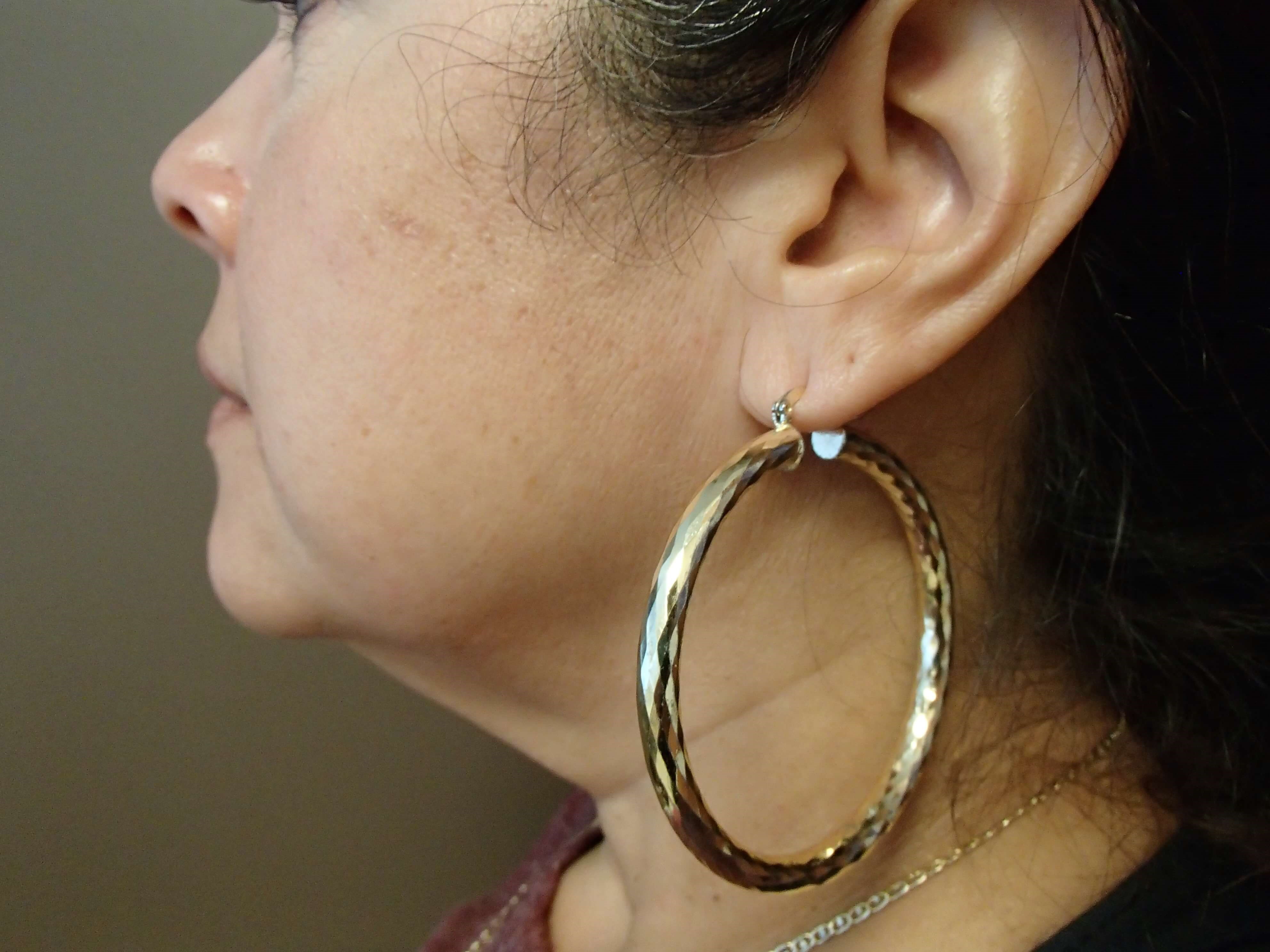 Necklift Before