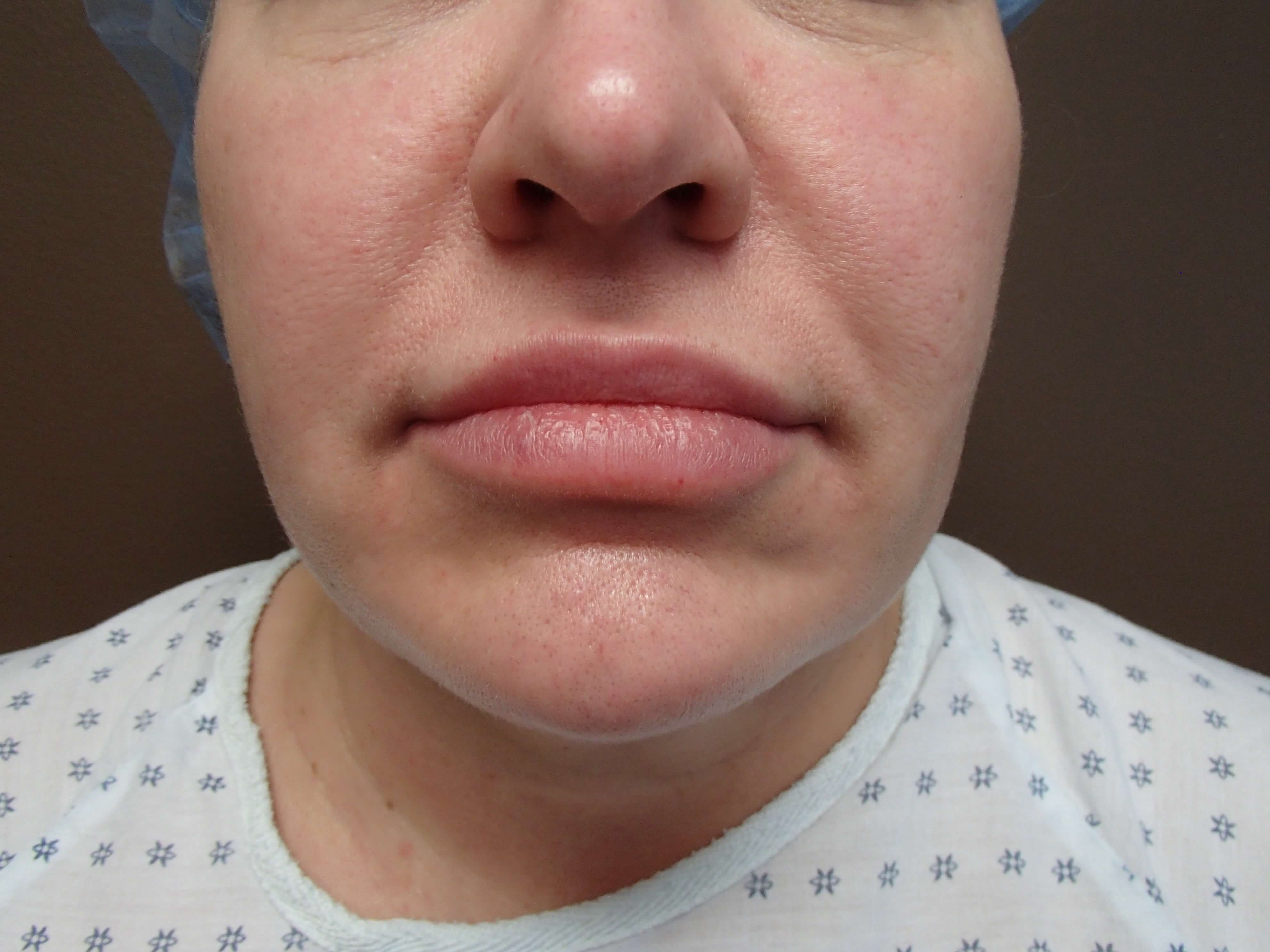 Before Image