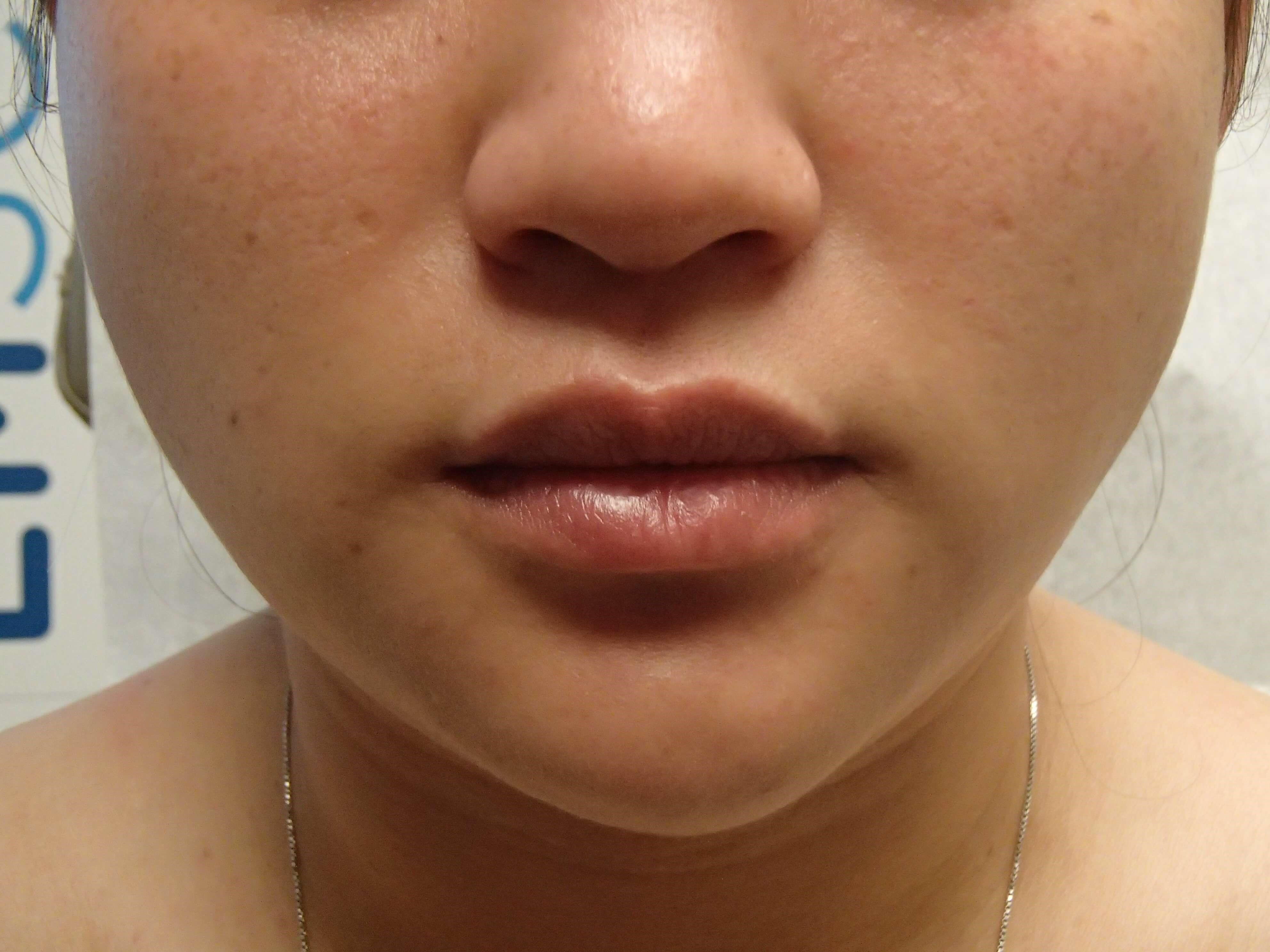Before Image