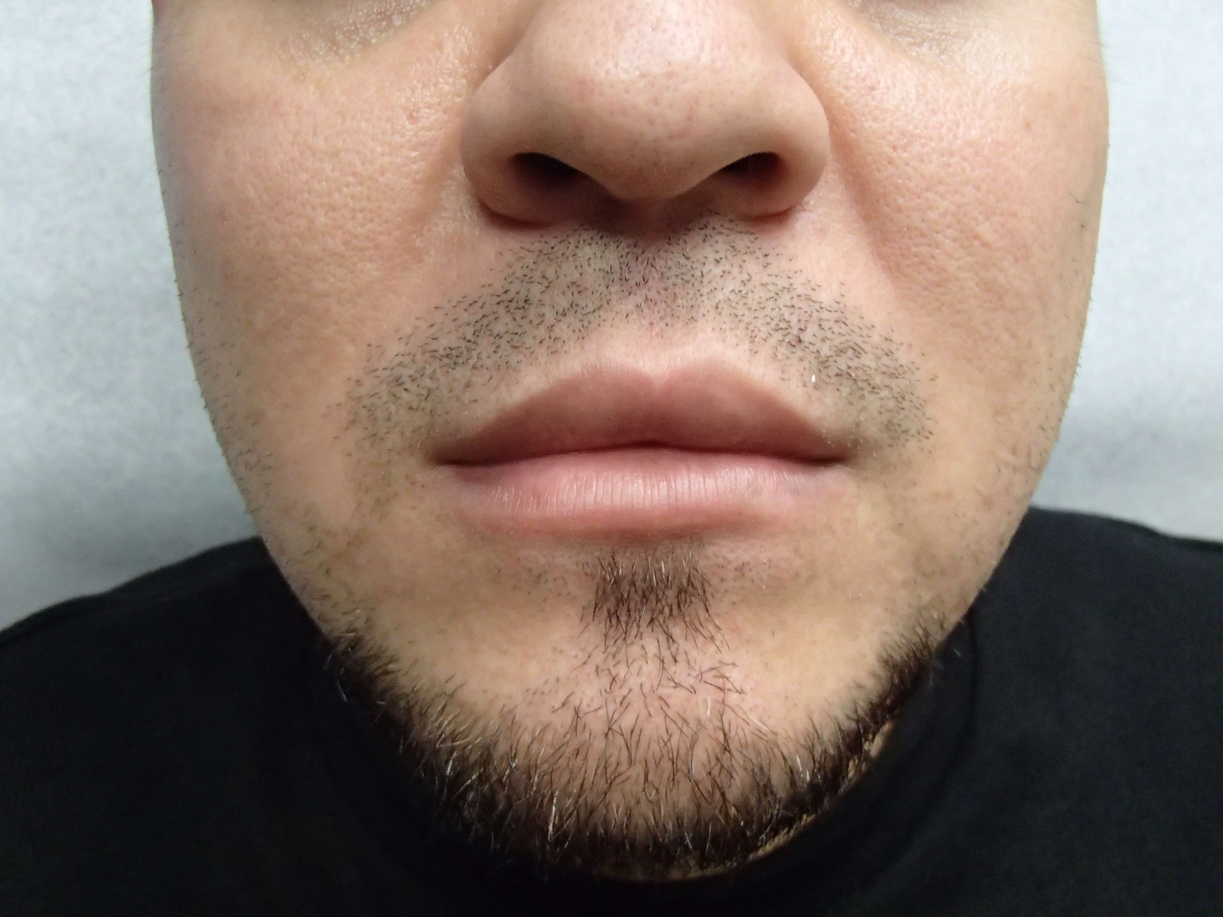Before Image