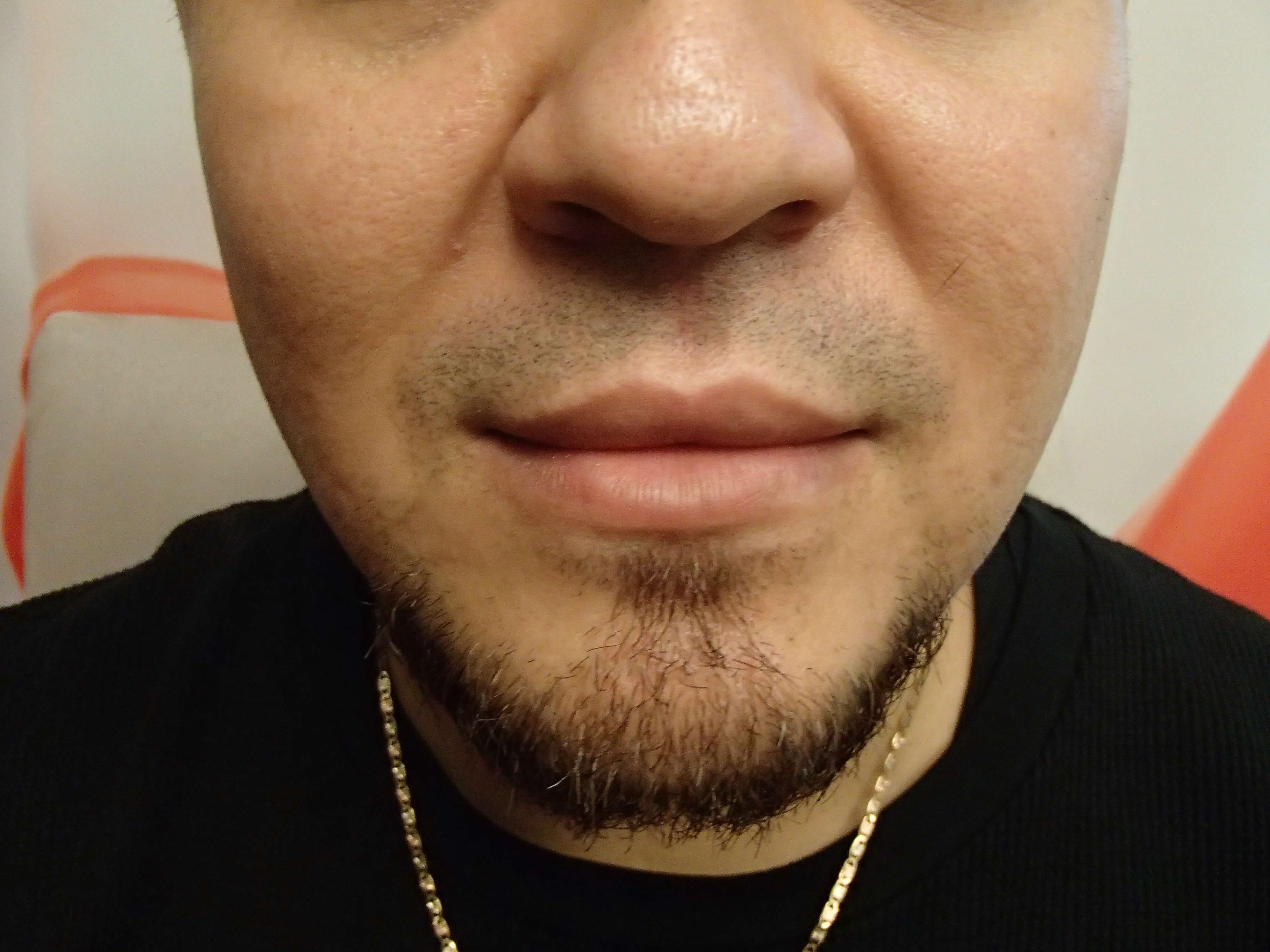After Image