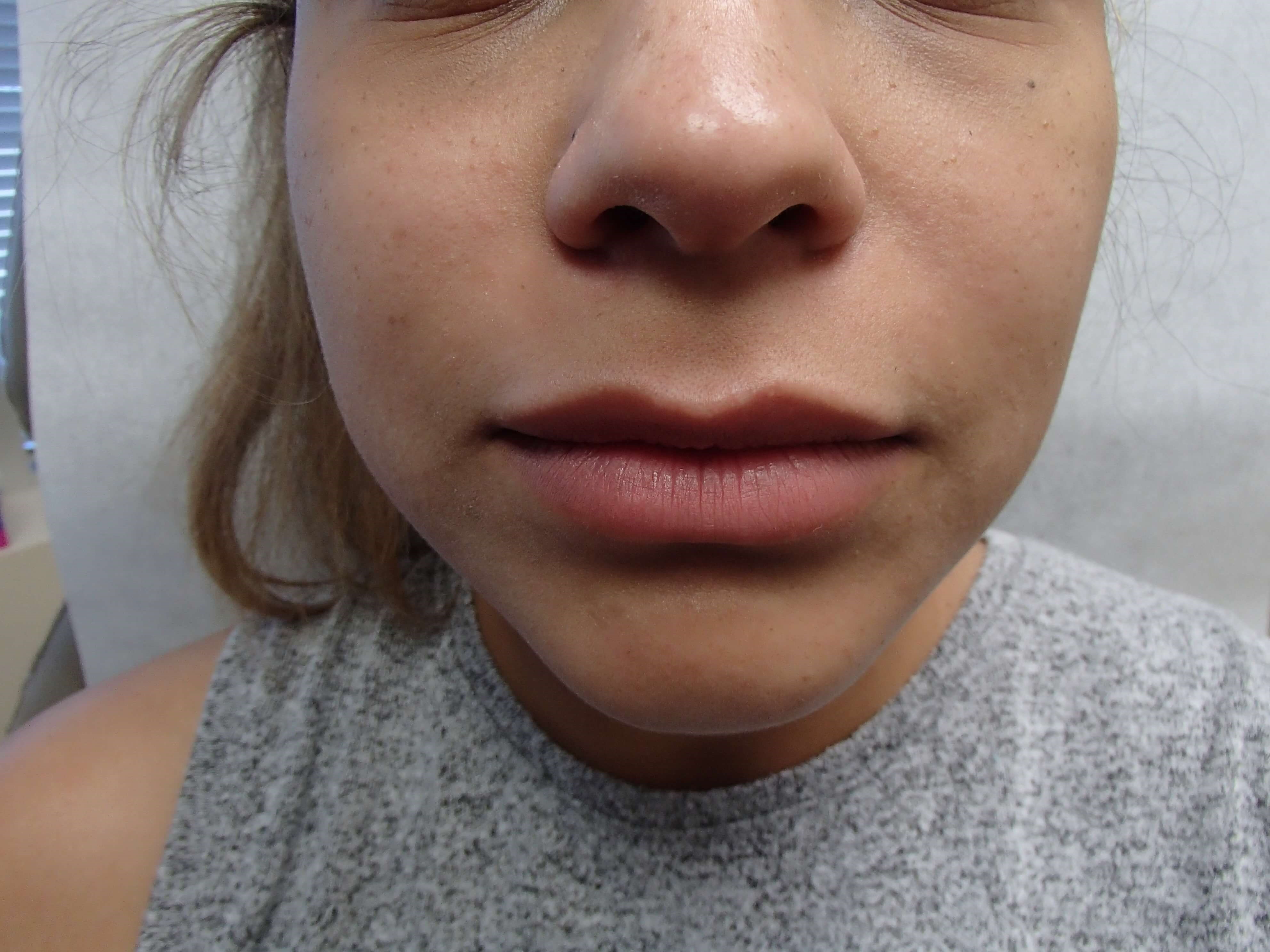 Before Image
