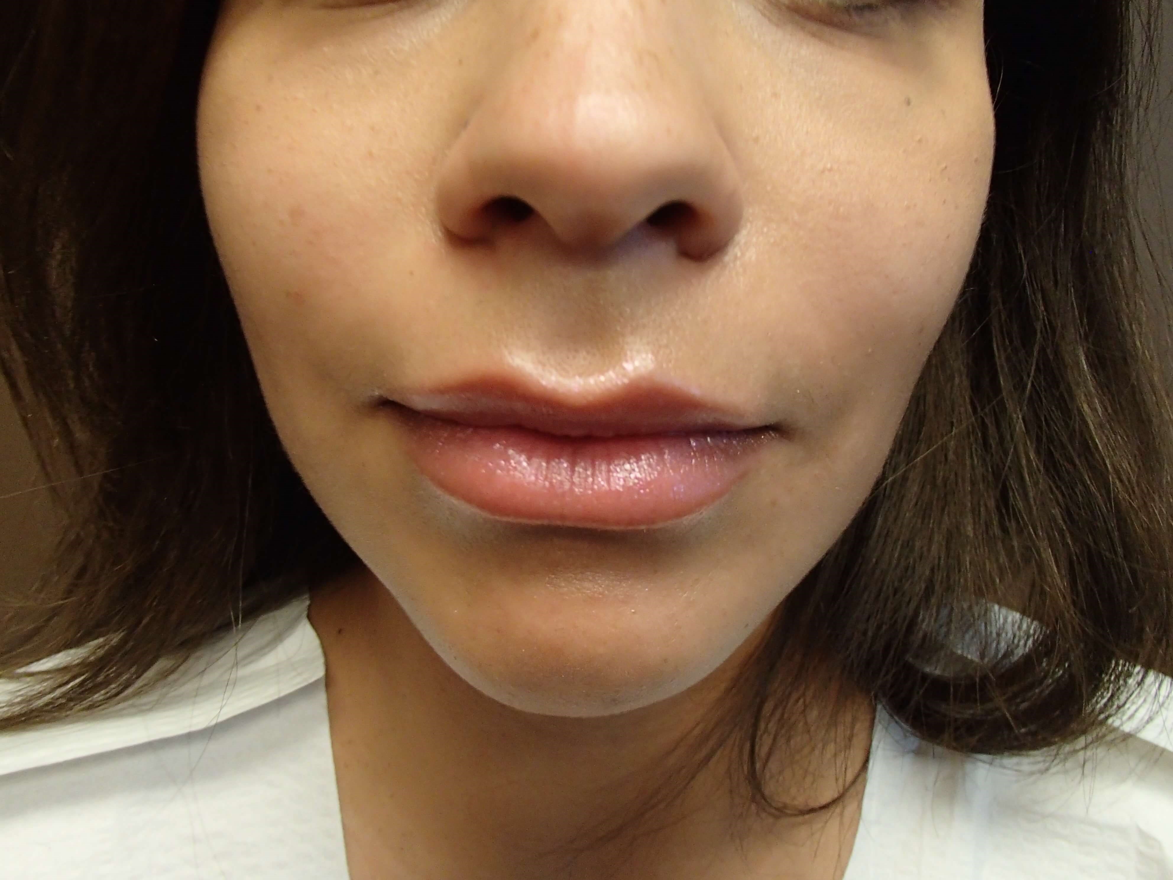After Image
