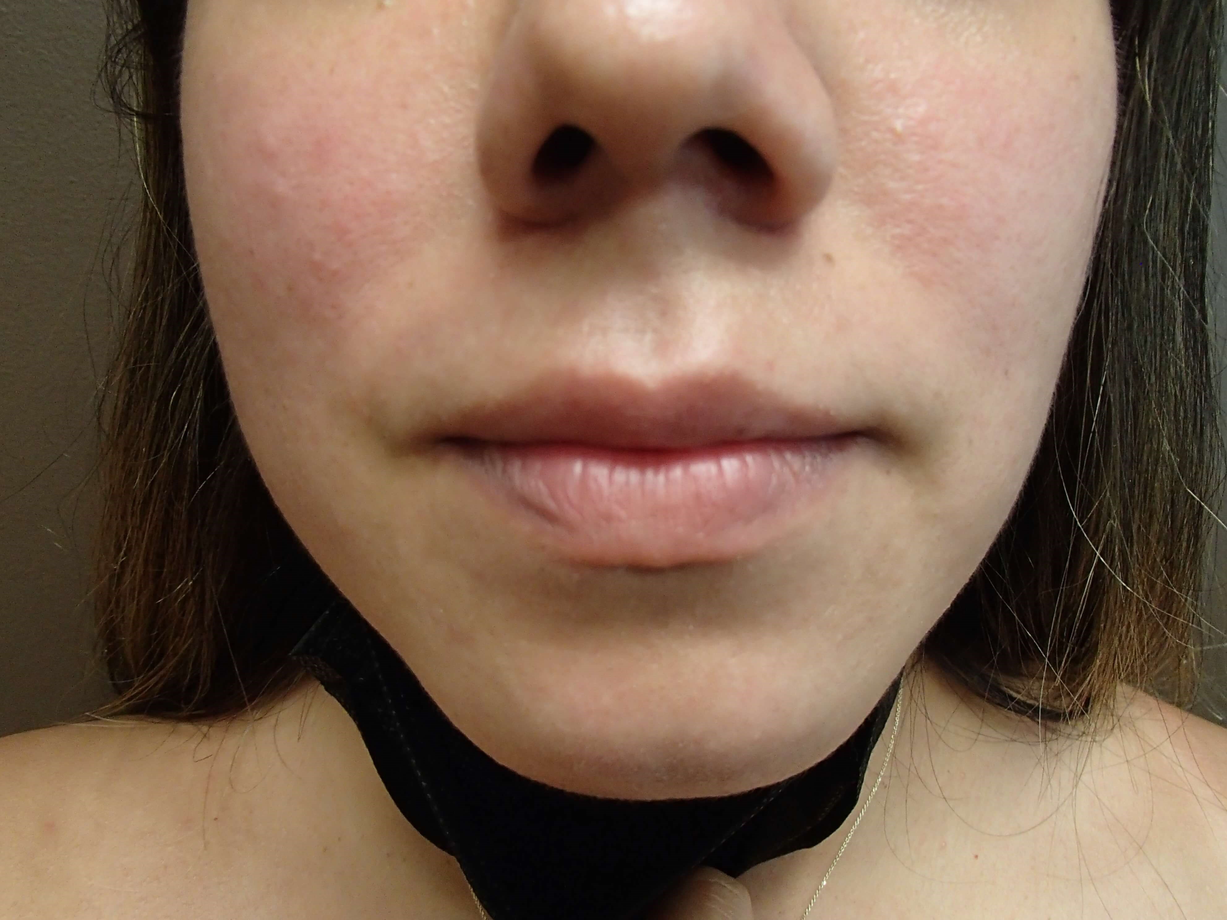 After Image