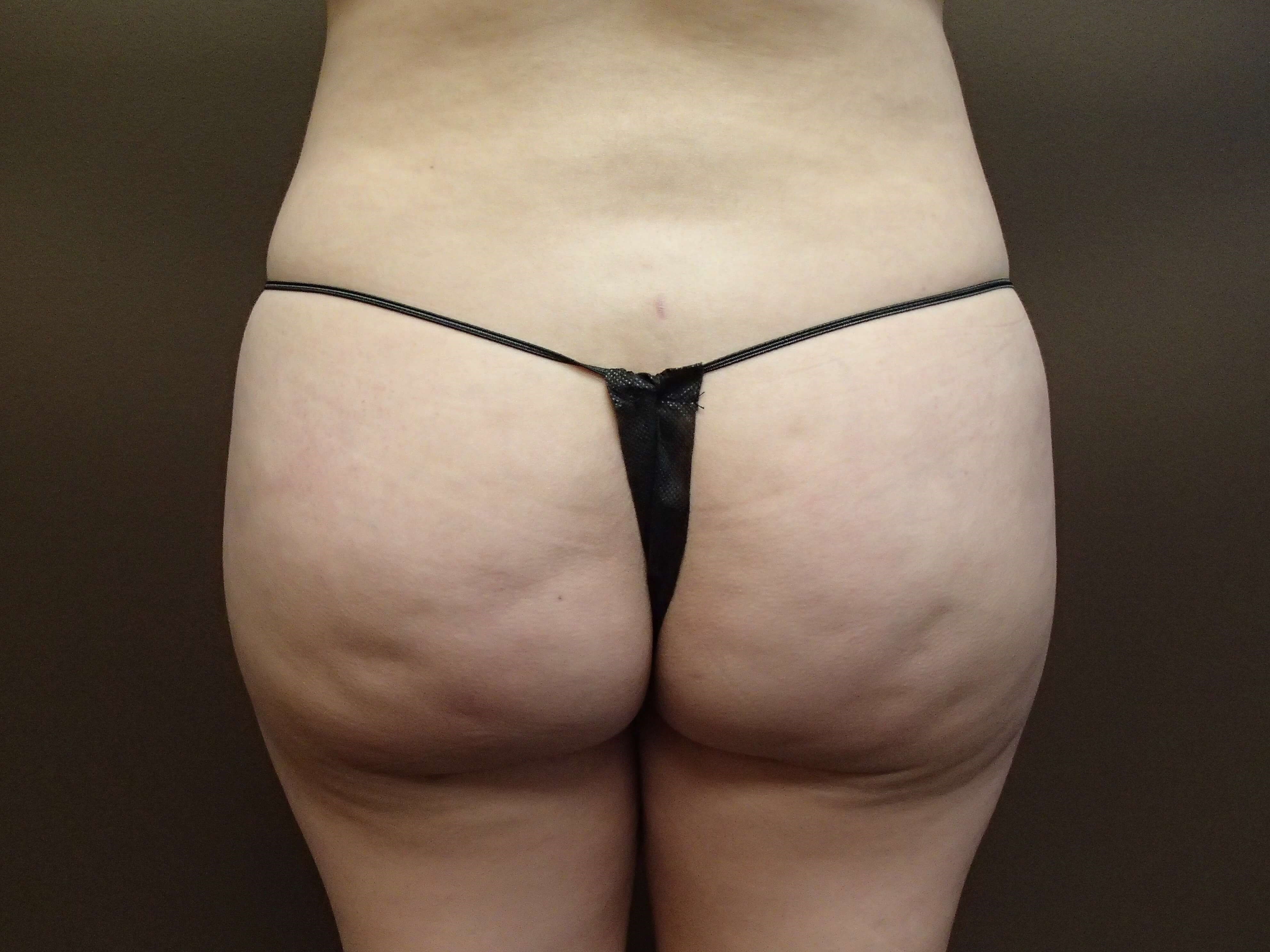 After Image