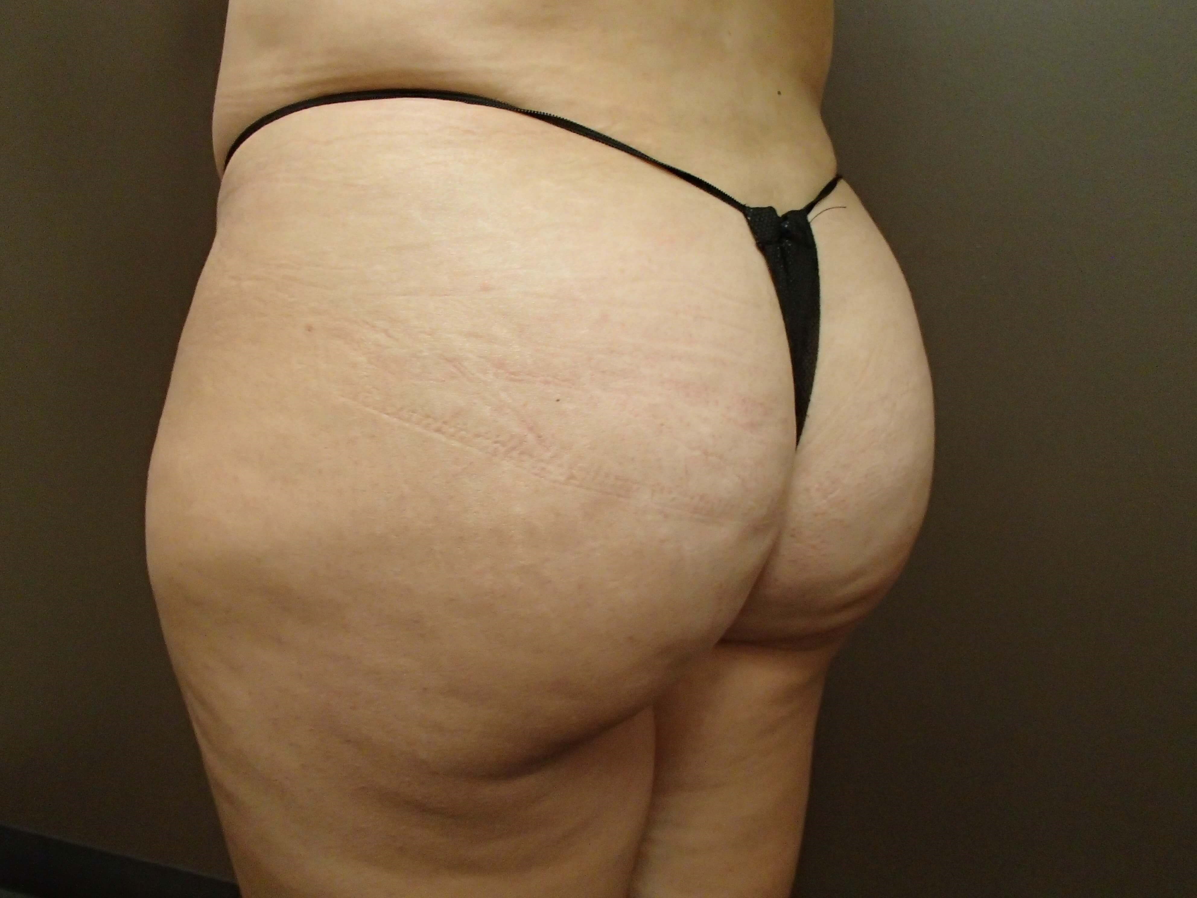 After Image