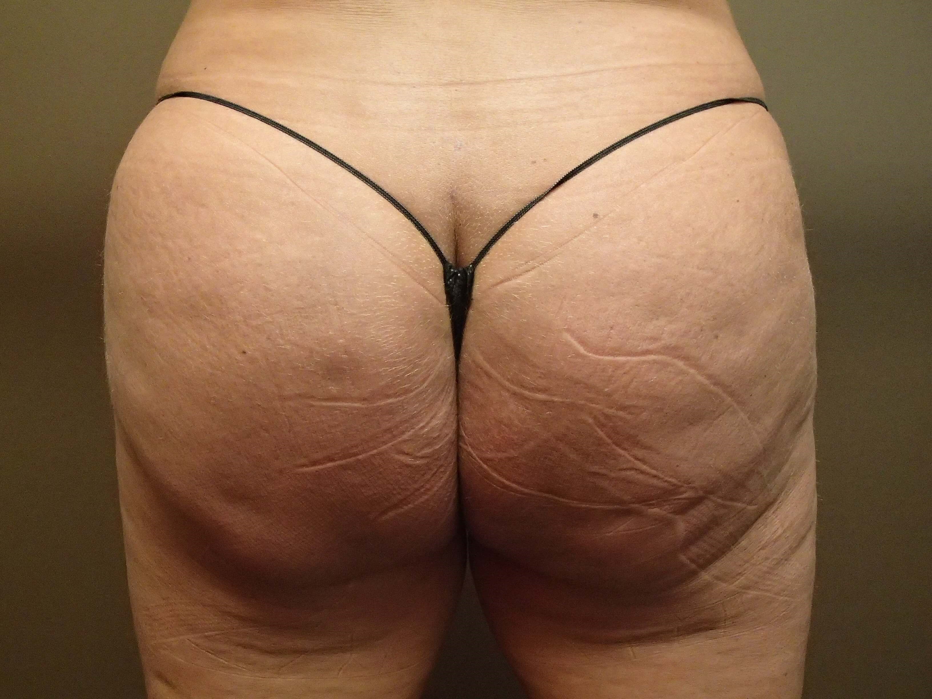 After Image