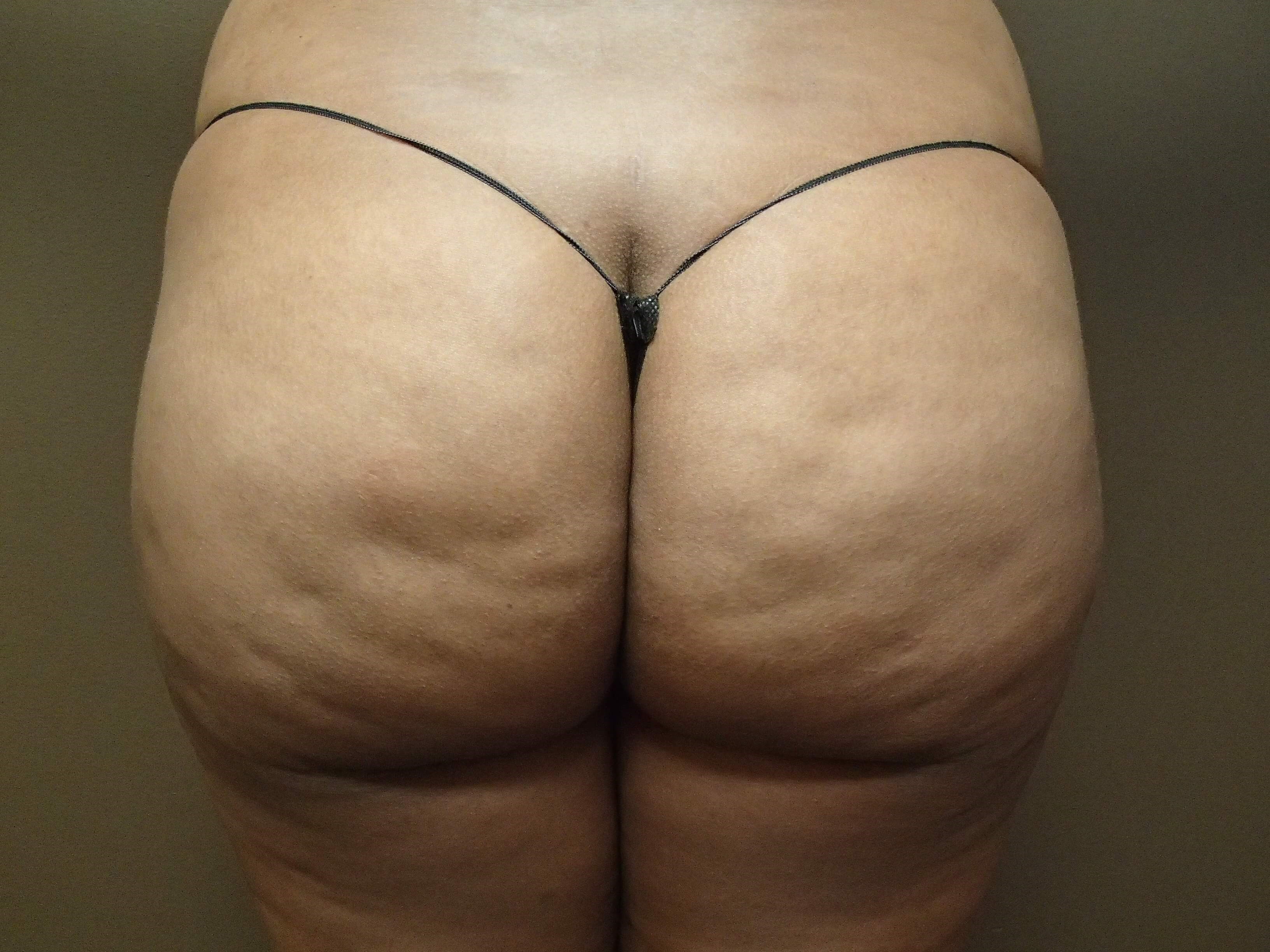 After Image