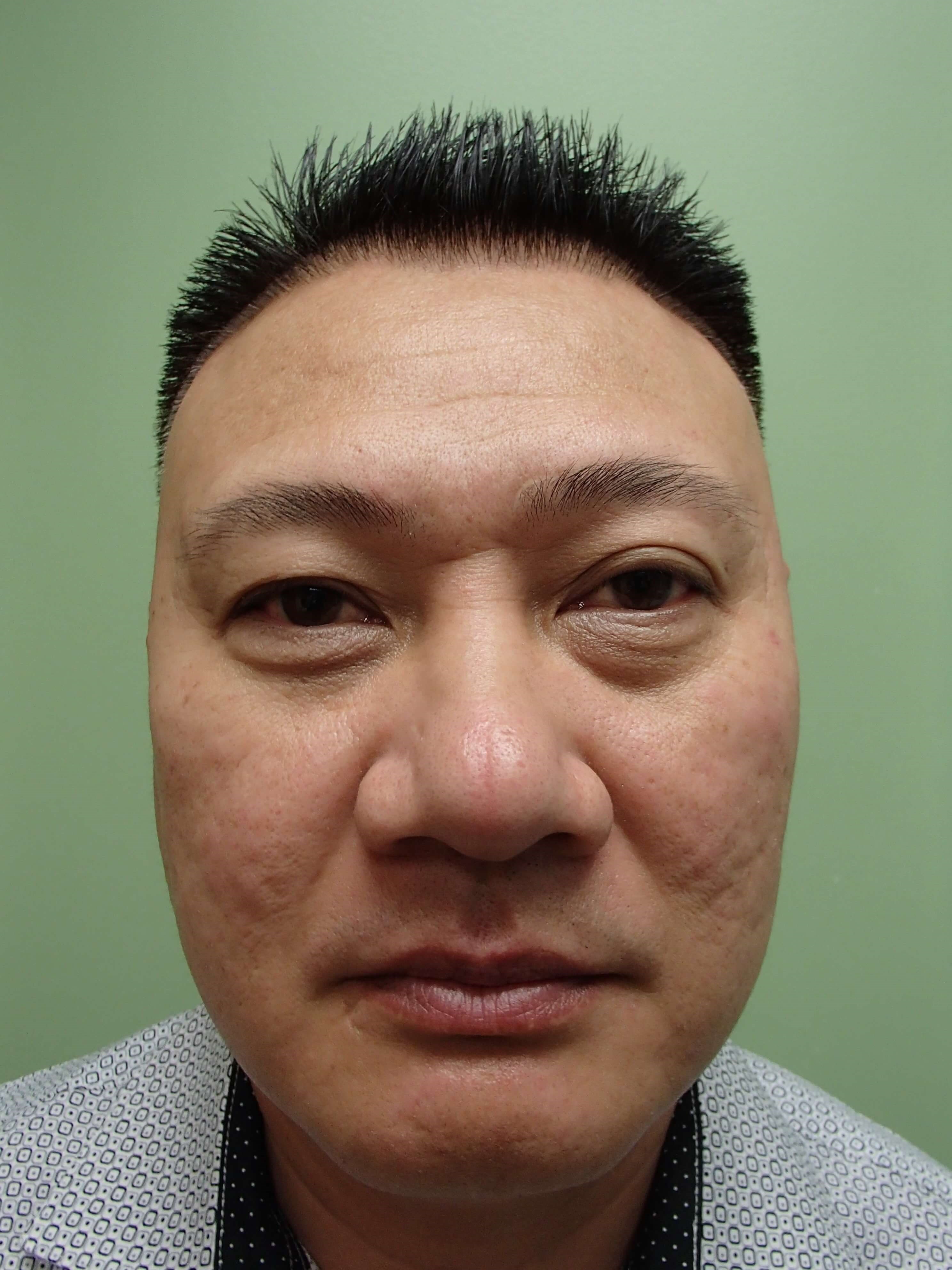 Before Image