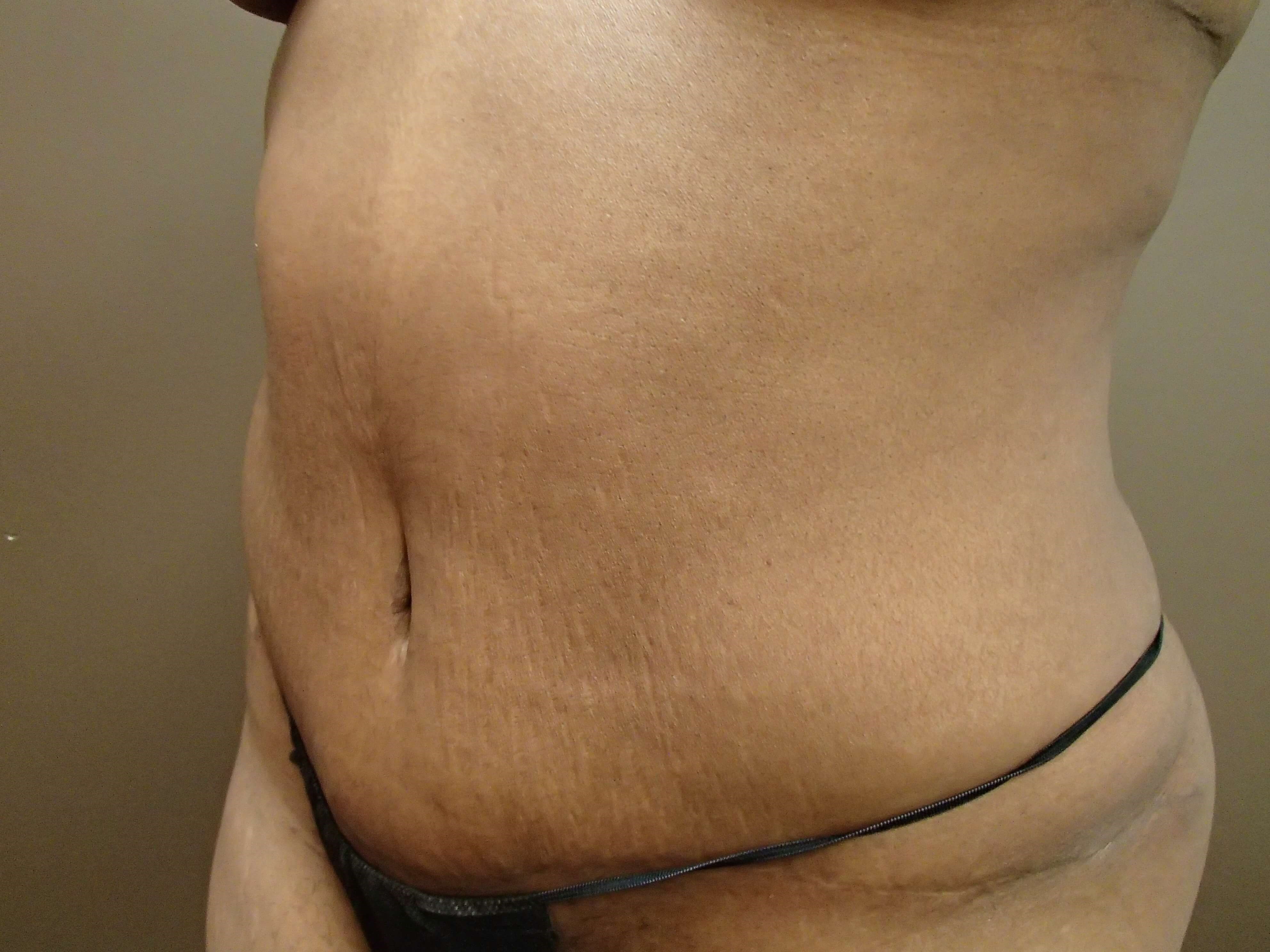 Timeless Tuck After