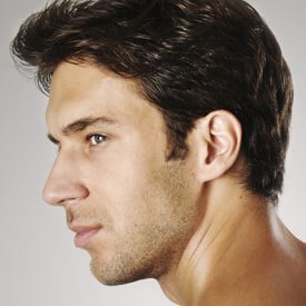Rhinoplasty